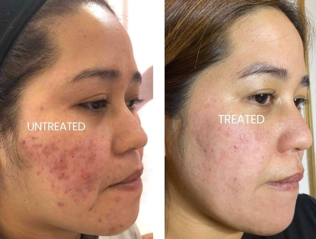 Erase Scars and Wrinkles