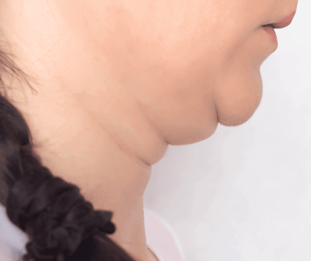 Facial Contouring