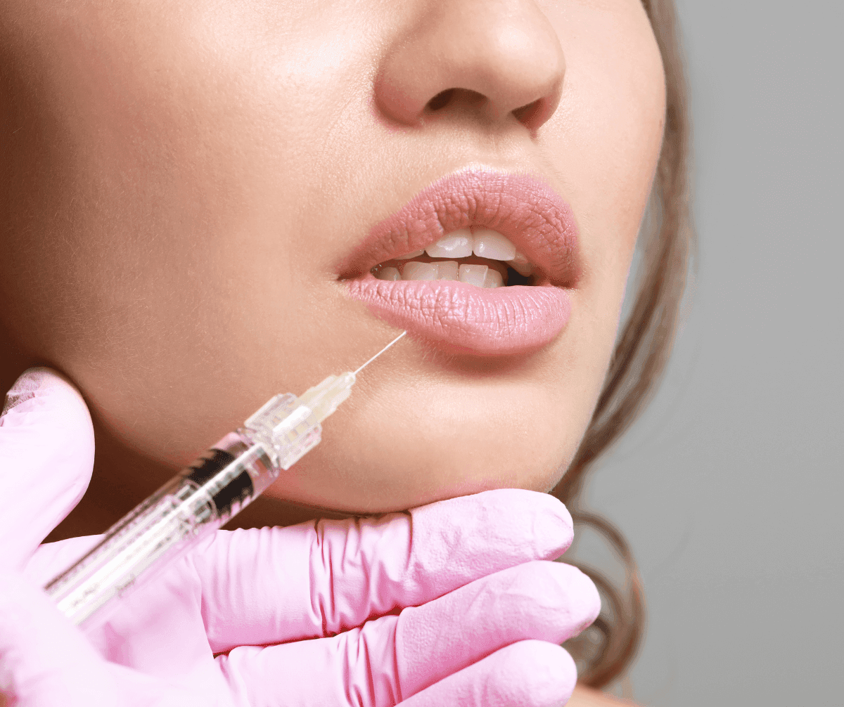 What are Dermal Fillers?