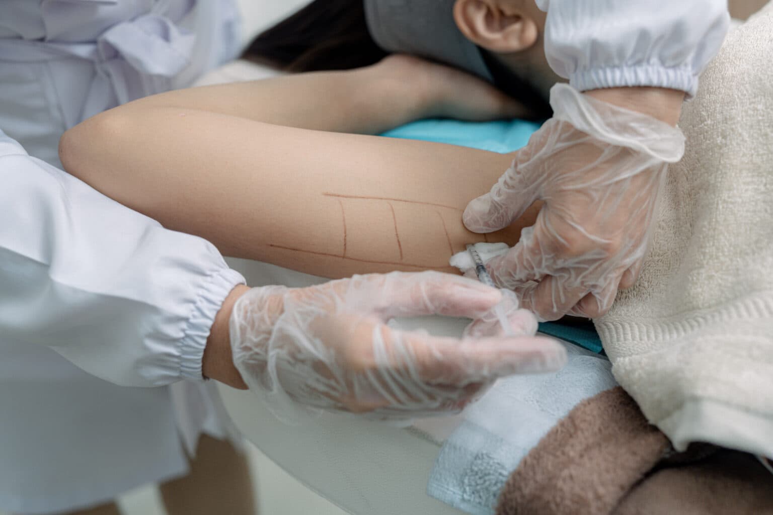 What is Meso Fat Melting?