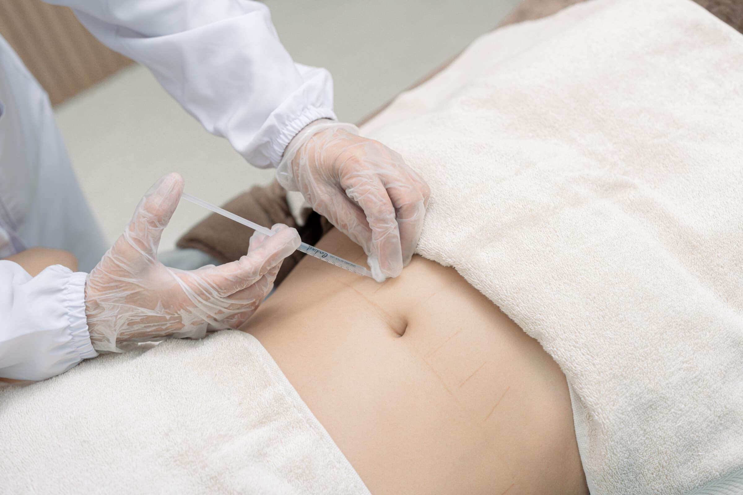 Targeted Fat Reduction with Meso Fat Melting