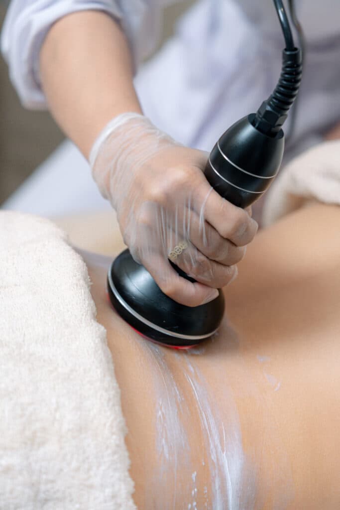 Firm, Tighten, and Contour with RF Sculpting