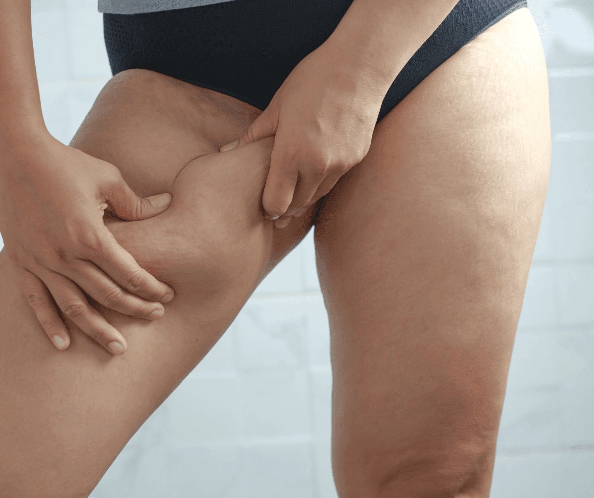 Limb Firming